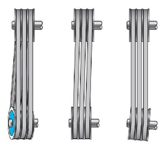 pulley-misalignment-examples